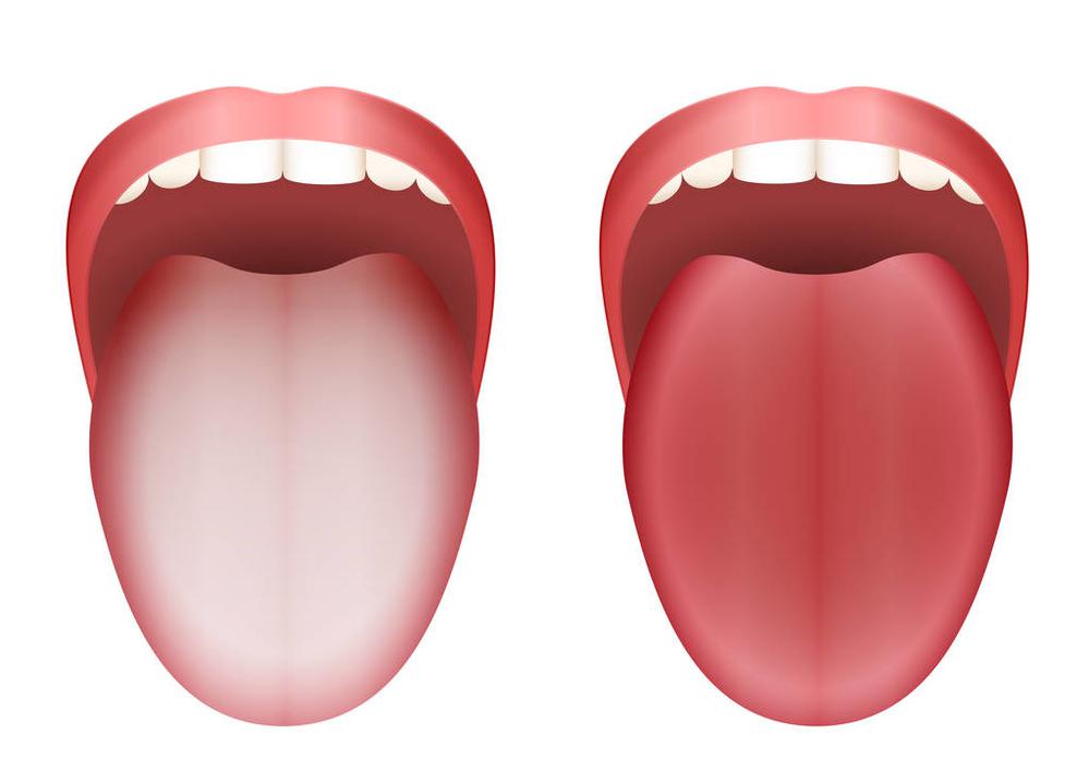 6招帮烫伤的舌头缓解疼痛