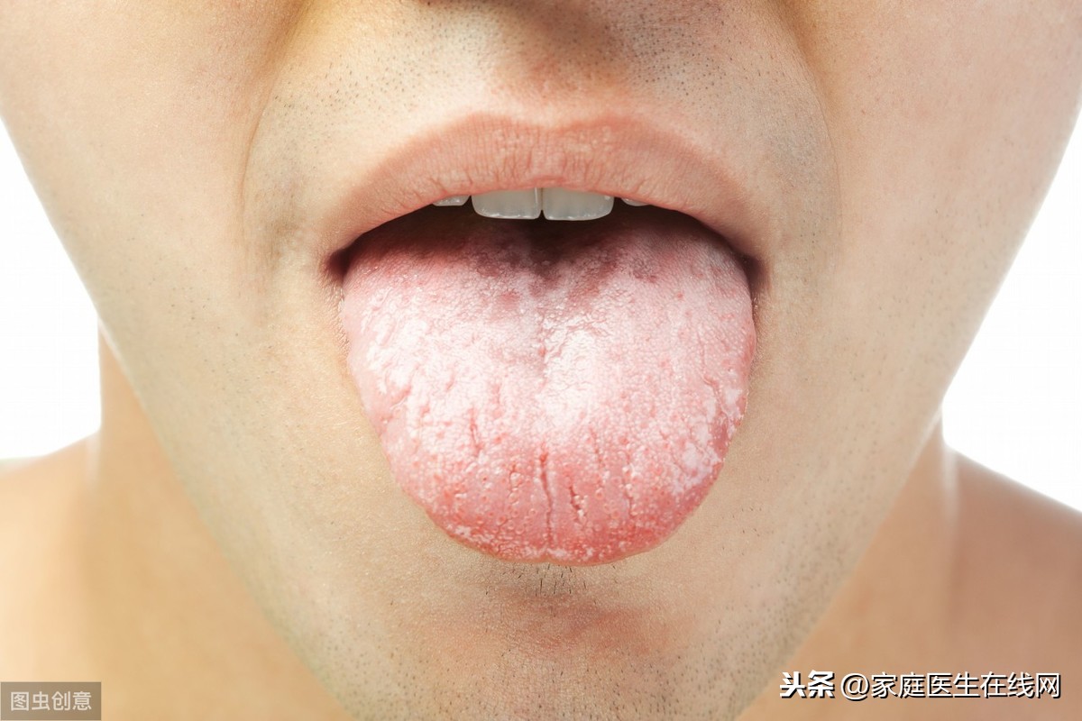 舌苔发白是怎么回事？原因有这5个，对照下