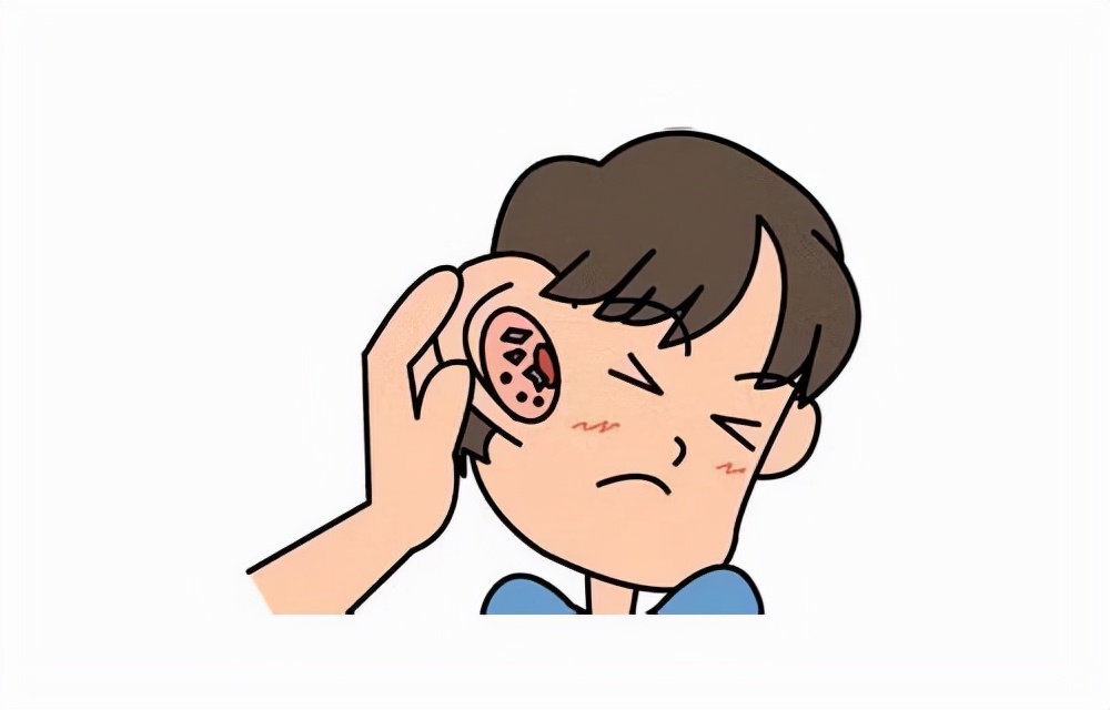 耳痛非小事！有可能得了中耳炎、耳疱疹、耳部肿瘤